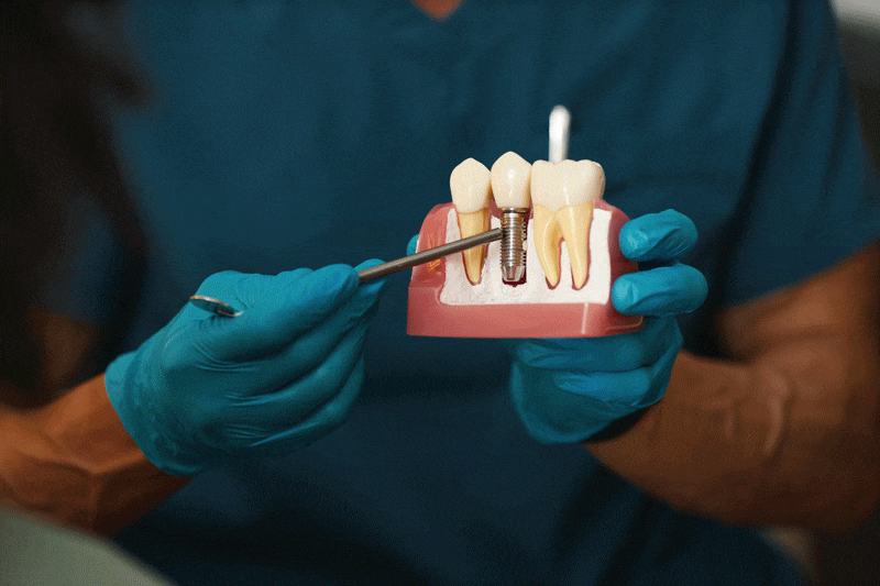 A dental model displaying teeth and an implant is held by blue-gloved hands. A dental tool points at the implant. The person wears a dark teal uniform against a neutral background.