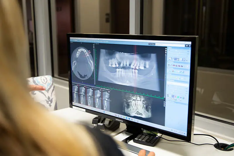 A computer screen displays dental X-ray images and scans, including a panoramic view of teeth and jaw, in a clinical setting. In the foreground, a person points at the display.