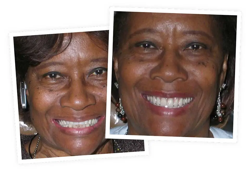 Two side-by-side portraits show a smiling woman. One photo is slightly tilted. She's wearing earrings and a necklace, emphasizing her cheerful expression. The background is indistinct.