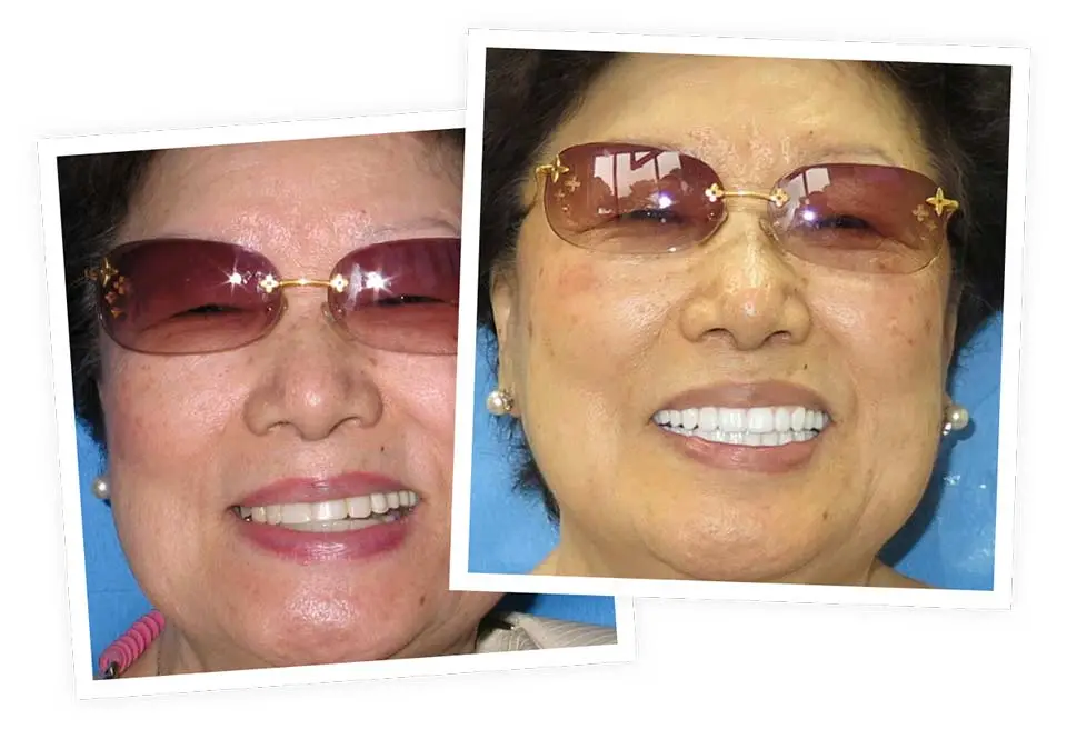 A person wearing sunglasses smiles broadly, showing teeth in two overlapping photos against a blue background. Pearl earrings are visible, emphasizing a pleasant demeanor.