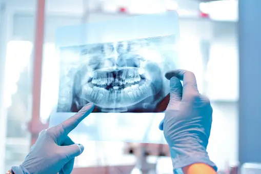 Gloved hands hold a dental X-ray, pointing at teeth, in a bright dental clinic with blurred equipment in the background.