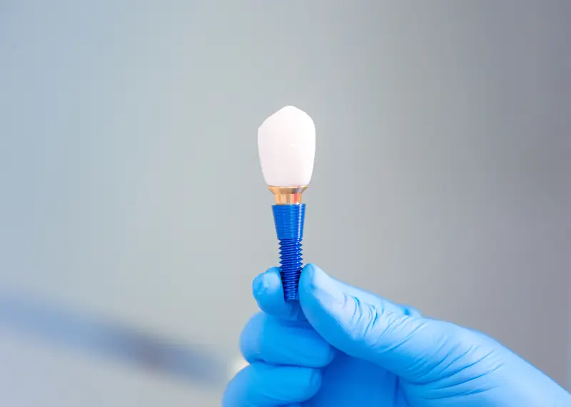 A gloved hand holds a dental implant with a white ceramic crown and blue screw, against a light gray background.