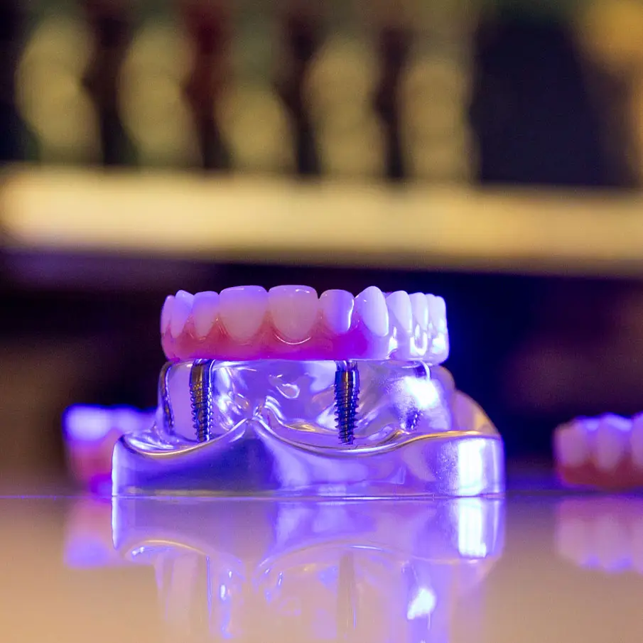 Dental model with visible implants, illuminated by purple light, resting on a reflective surface. The background features blurred, warm-toned lights.