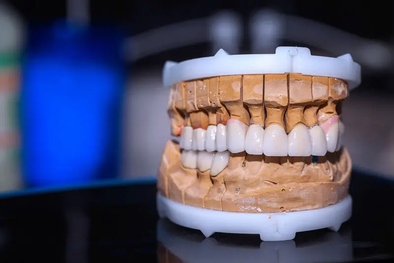 A dental mold displays aligned, realistic teeth within a plaster cast, set against a blurred, blue-lit background, likely in a dental or laboratory setting.