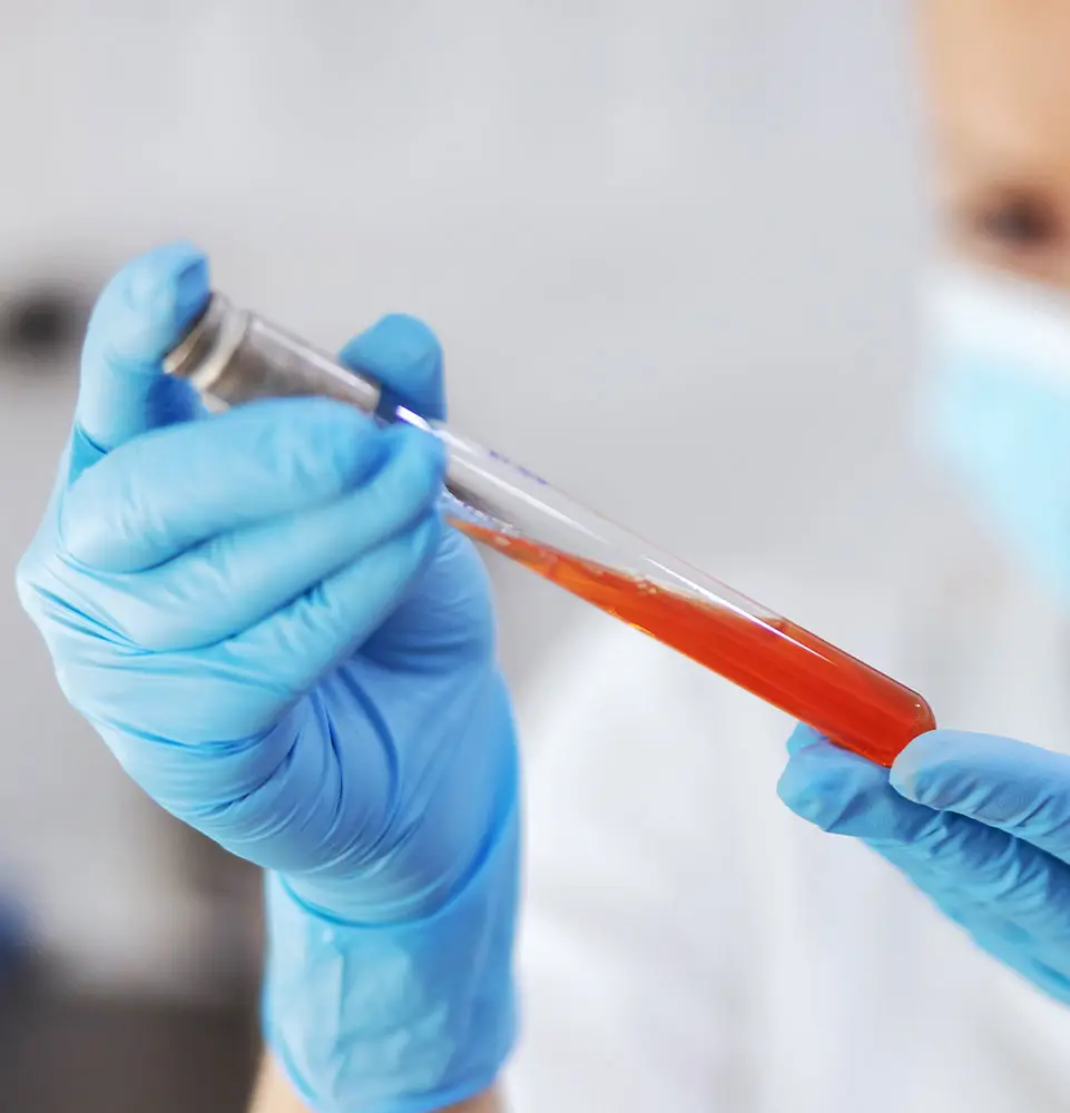 prf sample held by rdh